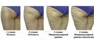 Кофейное обертывание от целлюлита в домашних условиях