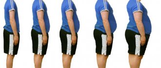 стадии ожирения у подростков